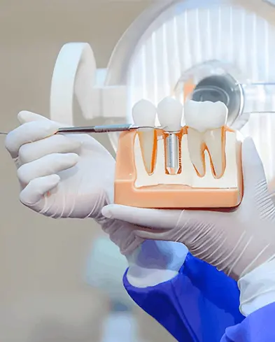 Dental Implants & Full Restoration